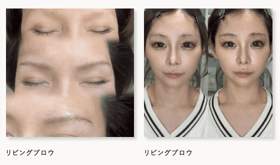 アートメイクギャラリー福岡天神院の症例写真